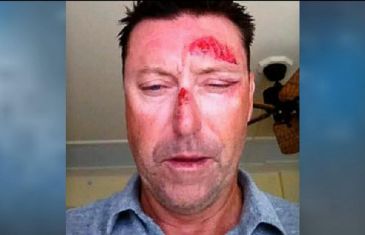 PGA’s Robert Allenby allegedly kidnapped and attacked in Hawaii