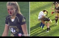 Women’s rugby player Georgia Page breaks her nose but finishes her tackles