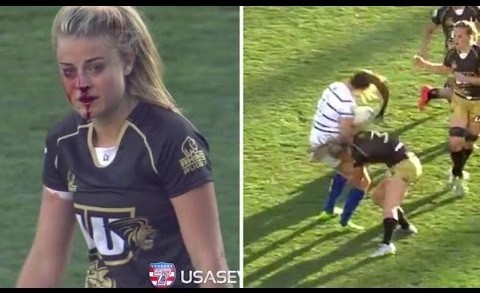 Women’s rugby player Georgia Page breaks her nose but finishes her tackles