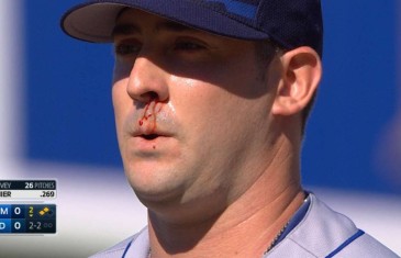Matt Harvey pitches through a nose bleed