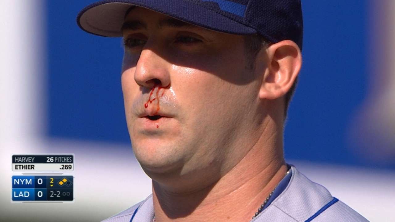 Matt Harvey pitches through a nose bleed
