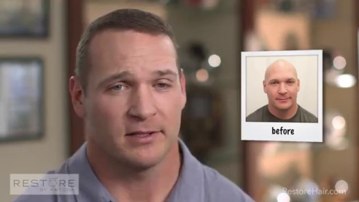 The story behind Brian Urlacher’s new hair