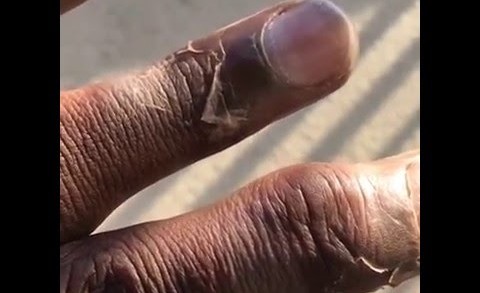 Kam Chancellor shows what happened to his fingers from the Vikings game