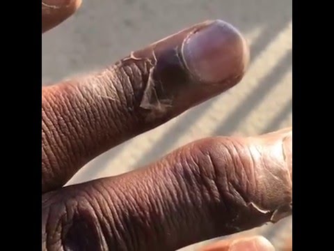 Kam Chancellor shows what happened to his fingers from the Vikings game