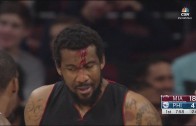 Amar’e Stoudemire gets a nasty cut on his forehead