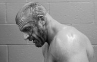 Triple H gets staples to his head after brutal head wound