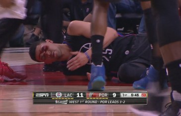 Austin Rivers extremely bloody after taking shot to his eye