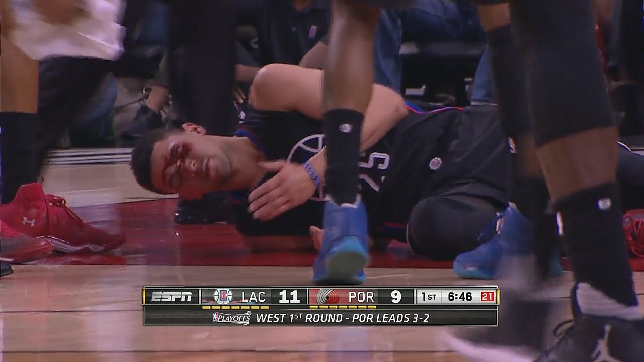 Austin Rivers extremely bloody after taking shot to his eye