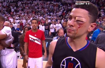 Austin Rivers looks like he’s been in a boxing match post Game 6