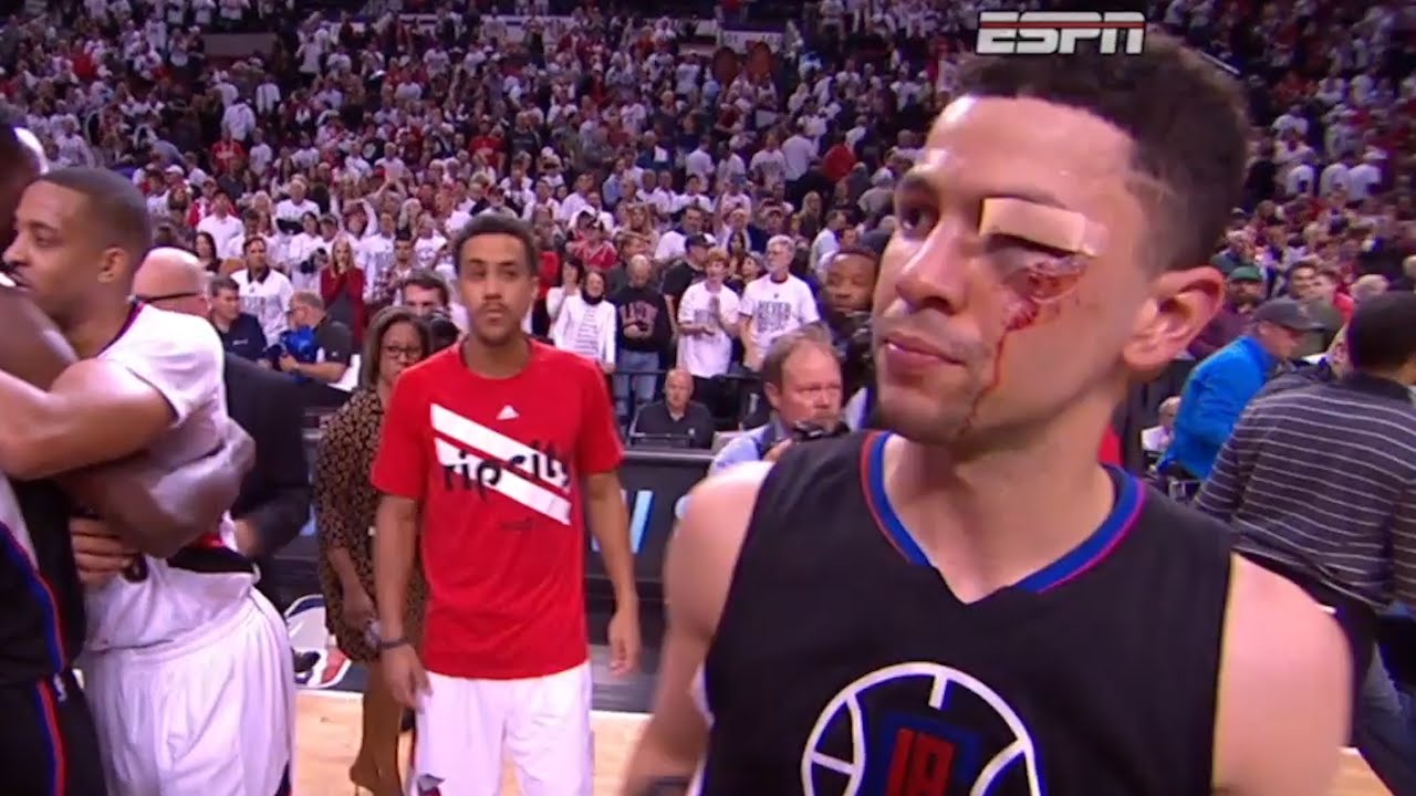 Austin Rivers looks like he's been in a boxing match post Game 6
