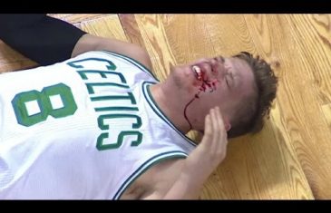 Boston’s Jonas Jerebko gets bloody after James Harden foul