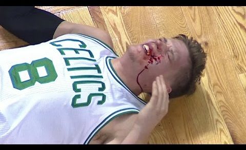 Boston’s Jonas Jerebko gets bloody after James Harden foul